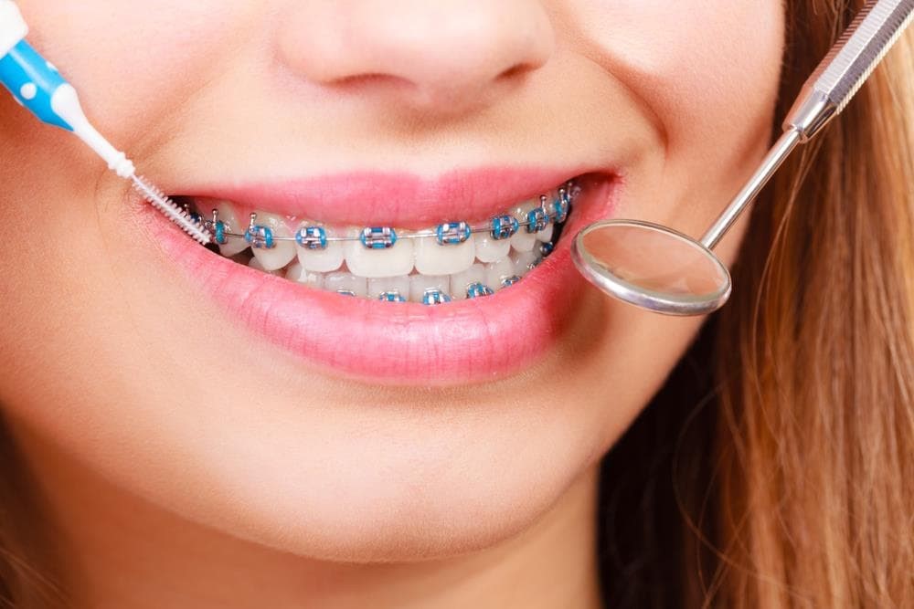 Comienza el año estrenando sonrisa: ¡Pon ortodoncia!