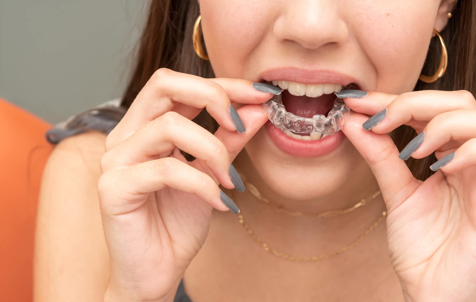 ¿Qué tratamiento de ortodoncia se adapta a ti?