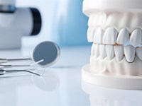 5 señales de que necesitas un tratamiento de periodoncia