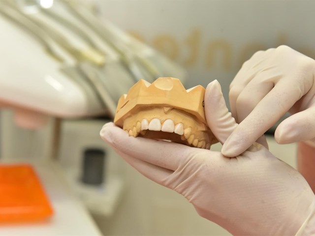 ¿Cómo limpiar los implantes dentales de manera correcta?