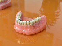 ¿Cómo se tienen que limpiar las dentaduras postizas?