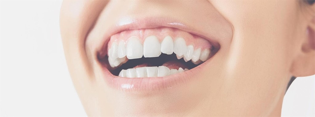 Conoce todo sobre la gingivitis