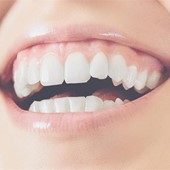 Conoce todo sobre la gingivitis