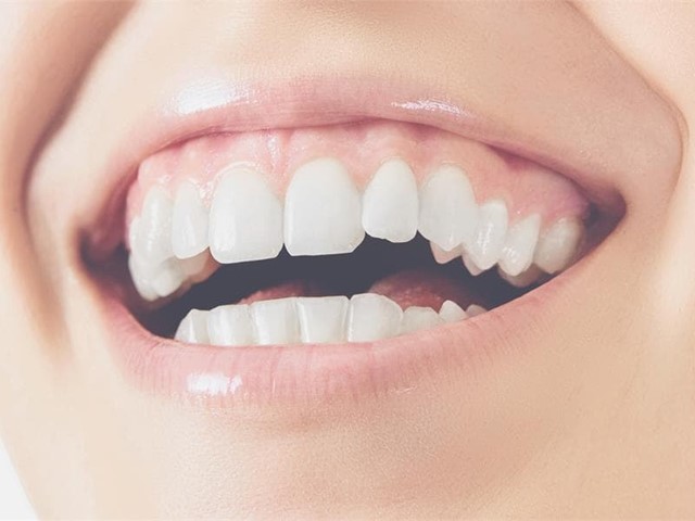 Conoce todo sobre la gingivitis