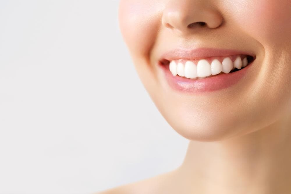 ¿Conoces los beneficios del blanqueamiento dental?