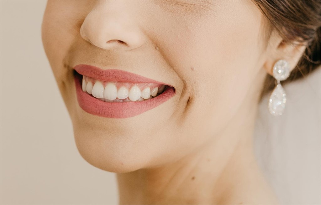 ¿Cuánto tiempo dura un blanqueamiento dental?