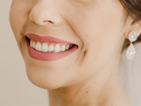 ¿Cuánto tiempo dura un blanqueamiento dental?