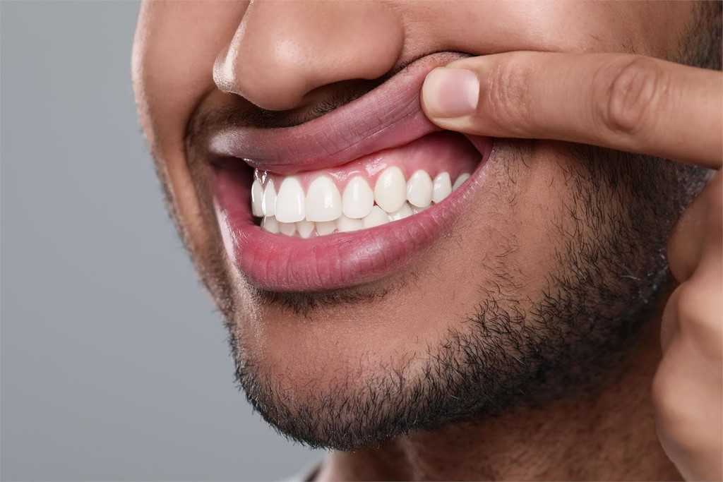 Cuida tus encías, ¿por qué es esencial la periodoncia?