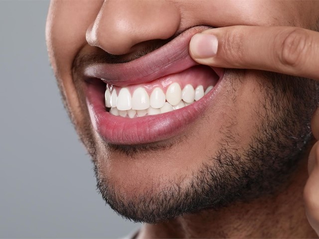 Cuida tus encías, ¿por qué es esencial la periodoncia?