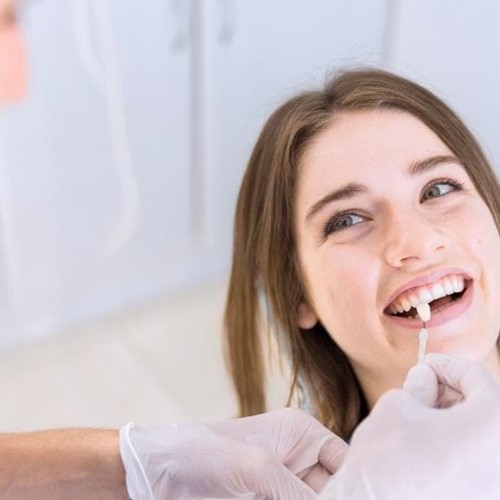 ¿En qué casos se recomienda el uso de carillas dentales?