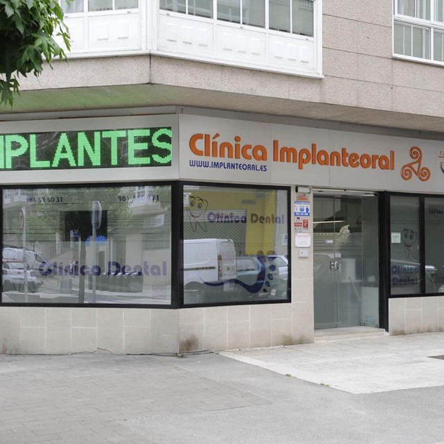 Especialistas en implantes dentales