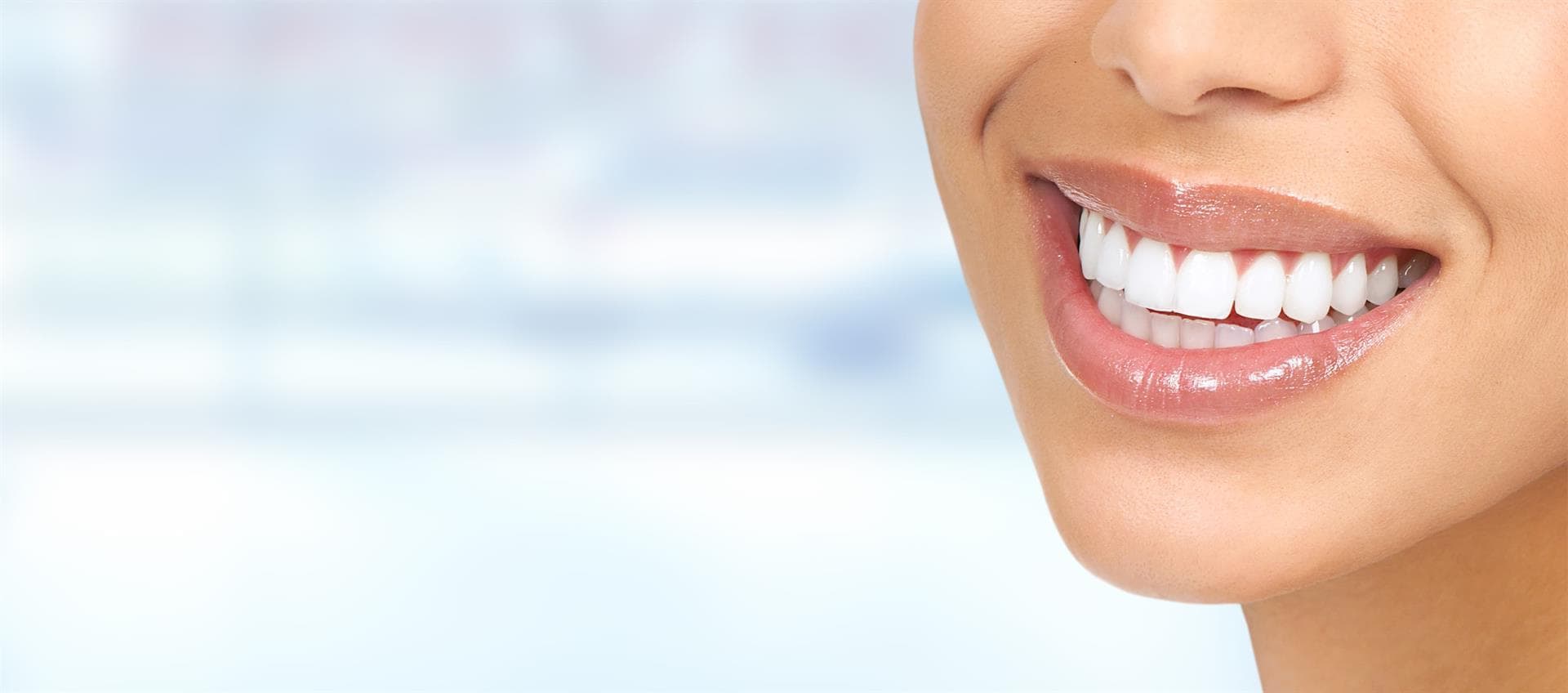 Carillas dentales en Santiago
