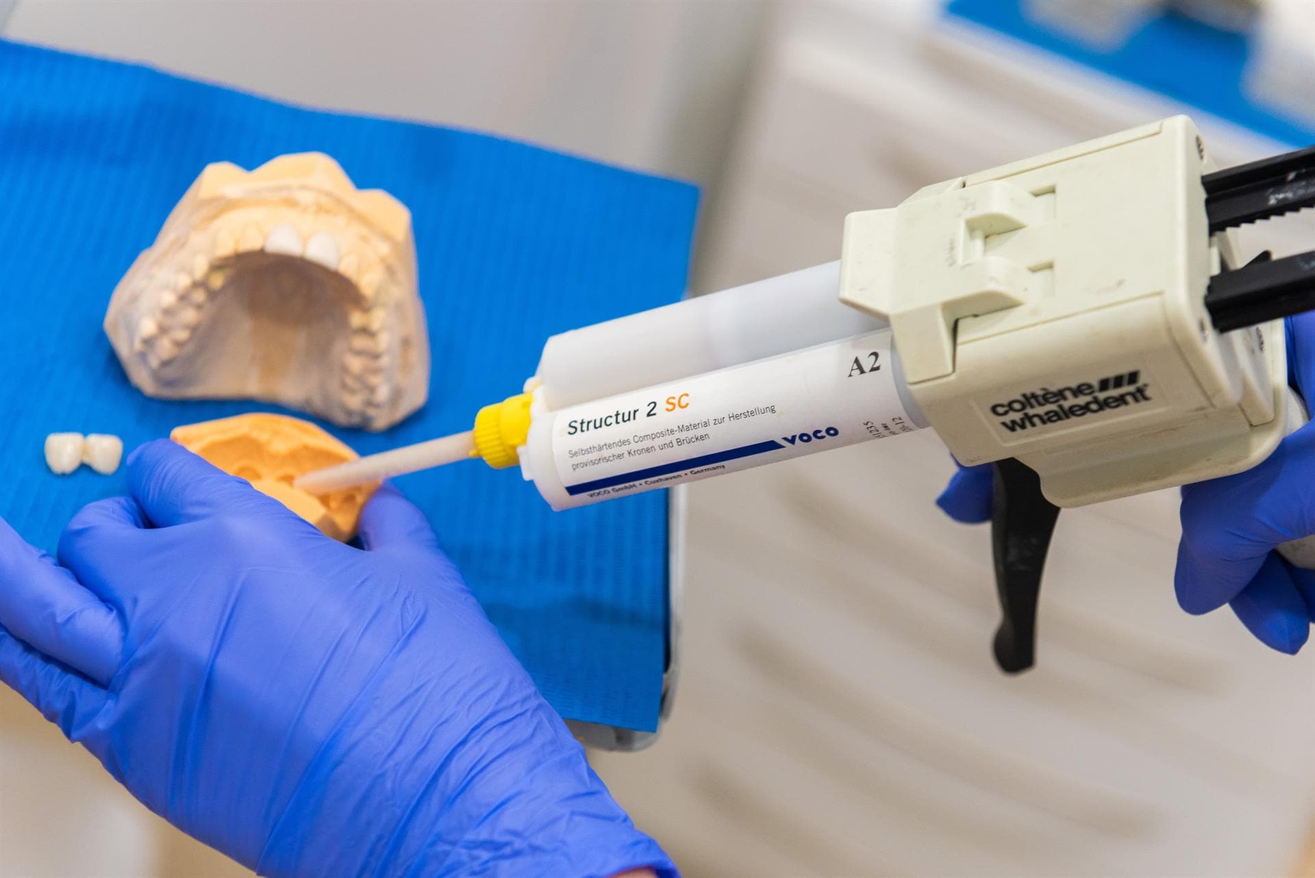 Proceso de colocación de las carillas dentales de composite