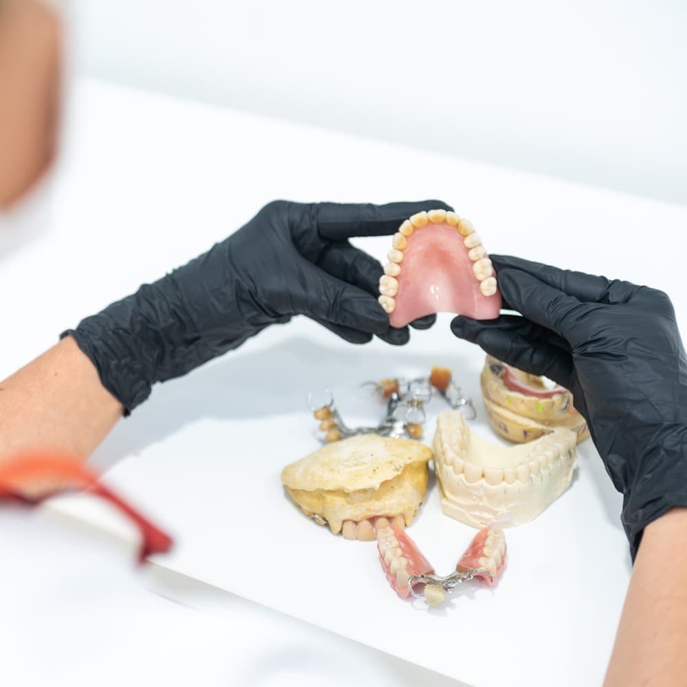 Preguntas frecuentes sobre implantes dentales