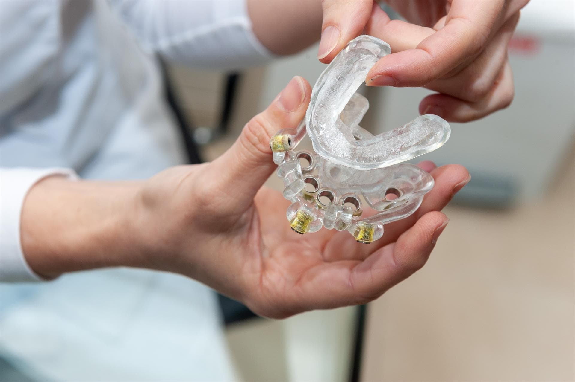 Implantes dentales en Santiago