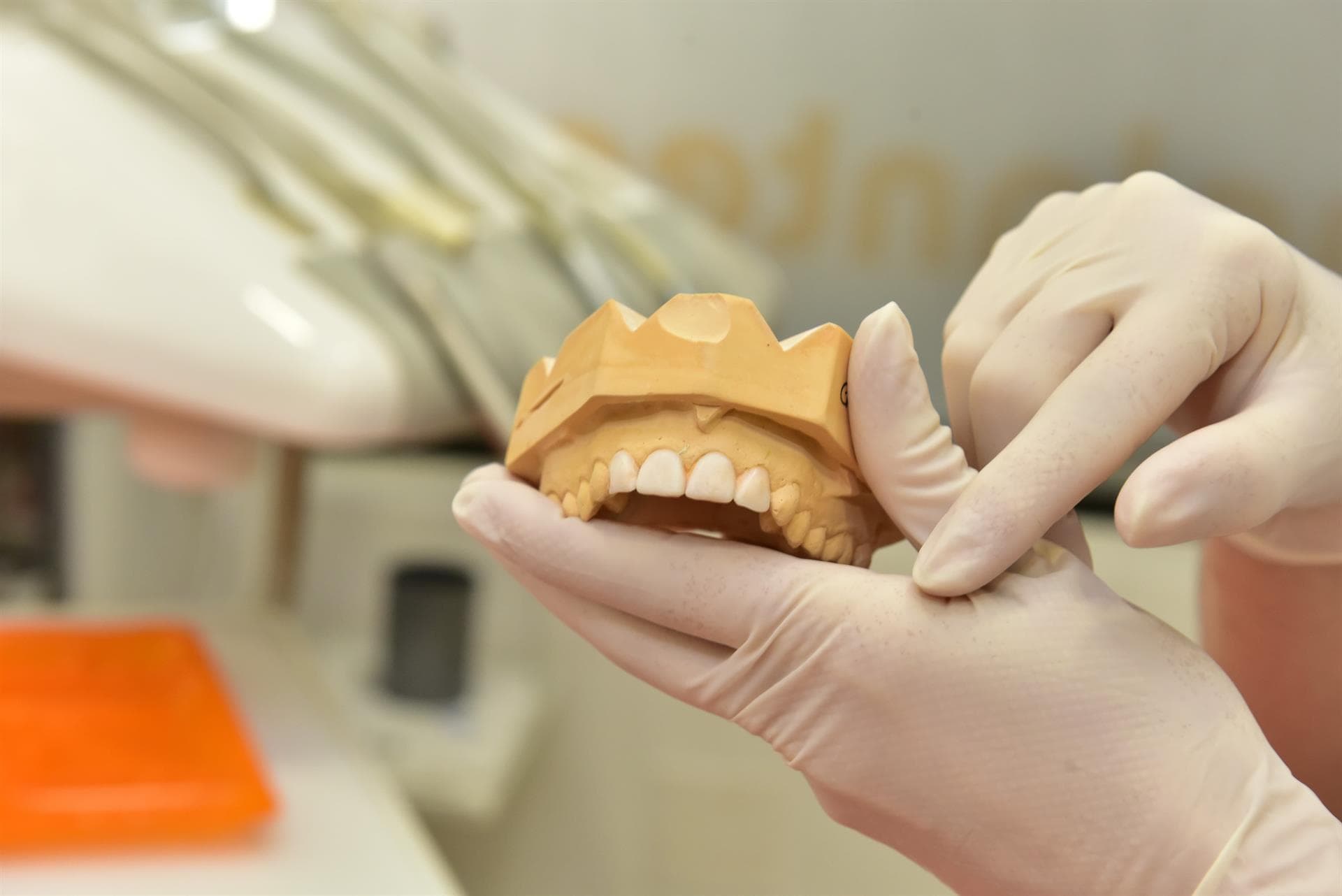 Sistema de implantes de carga inmediata All on Four en Santiago