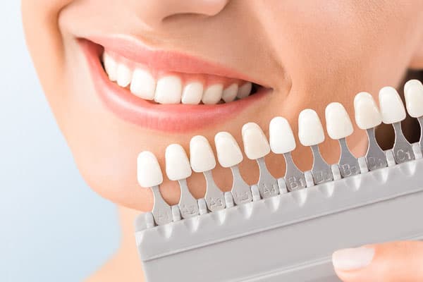 Profesionales del blanqueamiento dental en Santiago