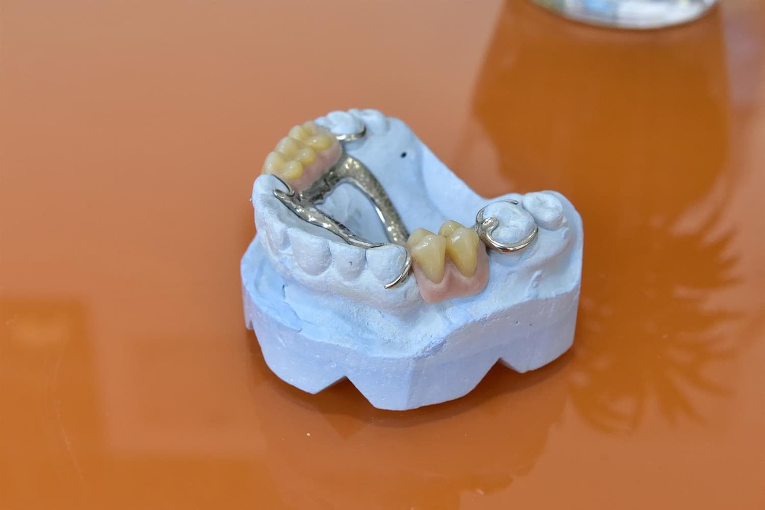 Sistema CAD-CAM para prótesis dentales en Santiago