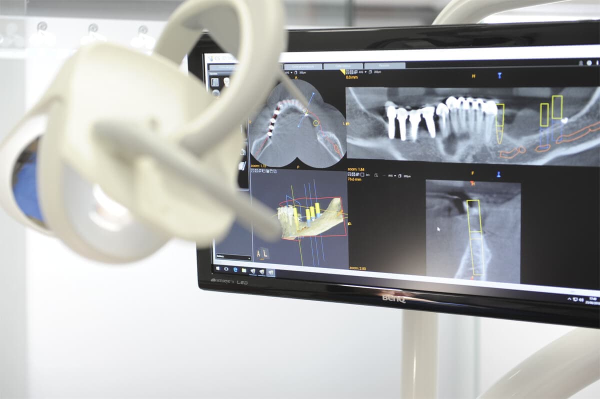 Dentistas expertos en prótesis dentales en Santiago