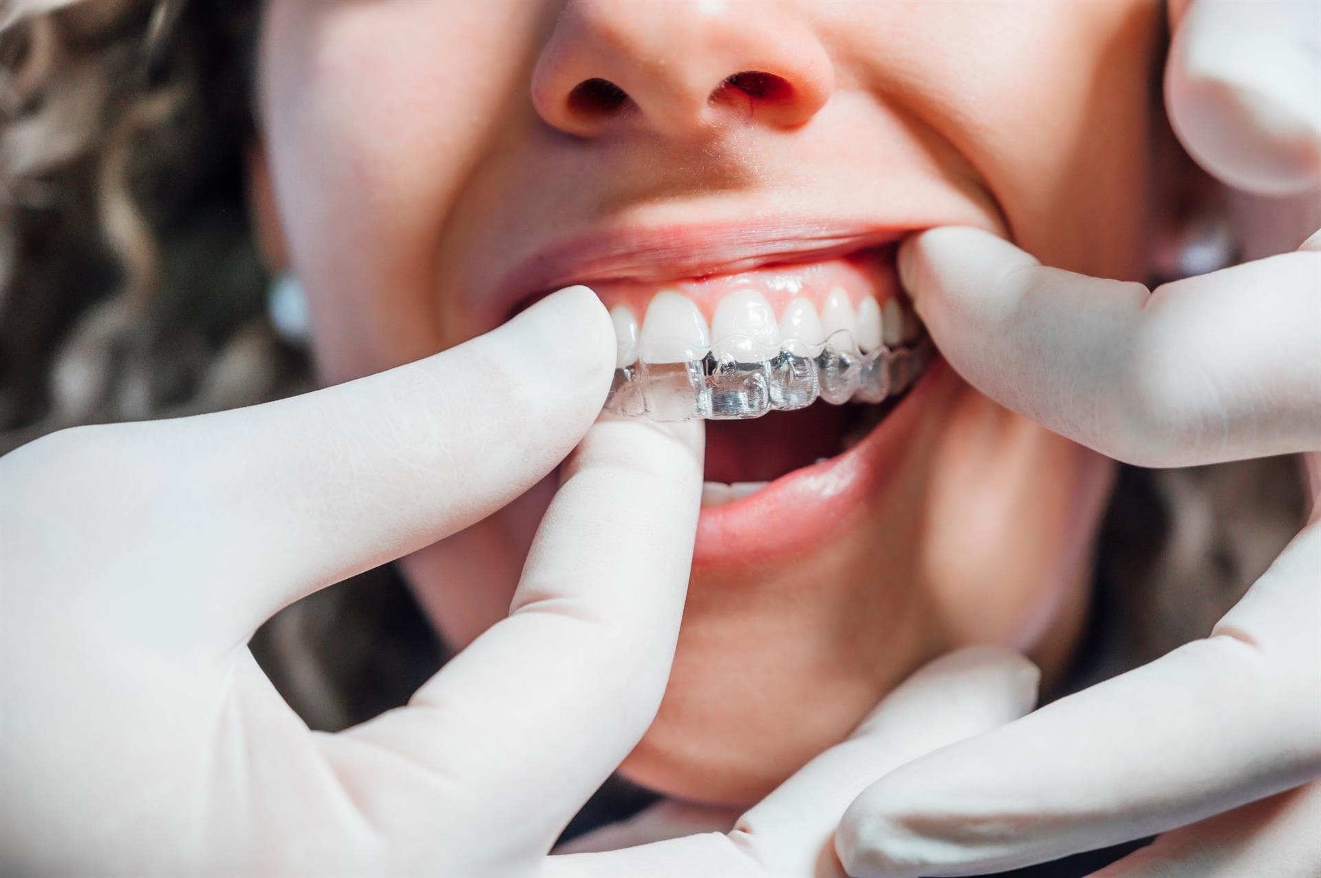  Un plan de tratamiento totalmente personalizado en tu ortodoncia invisible