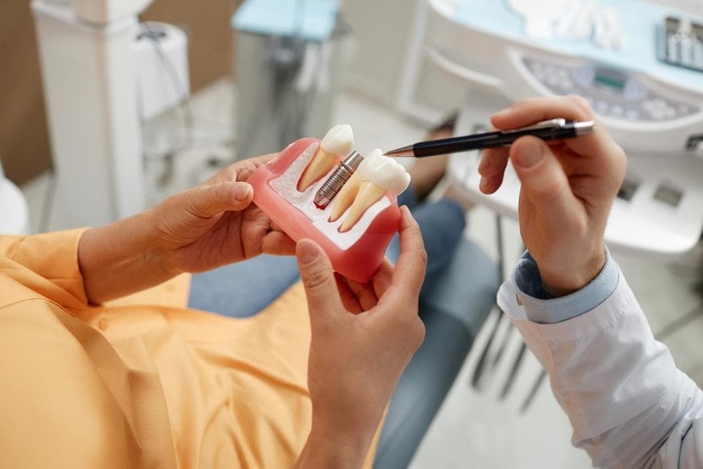 Implante dental: recupera ese diente perdido