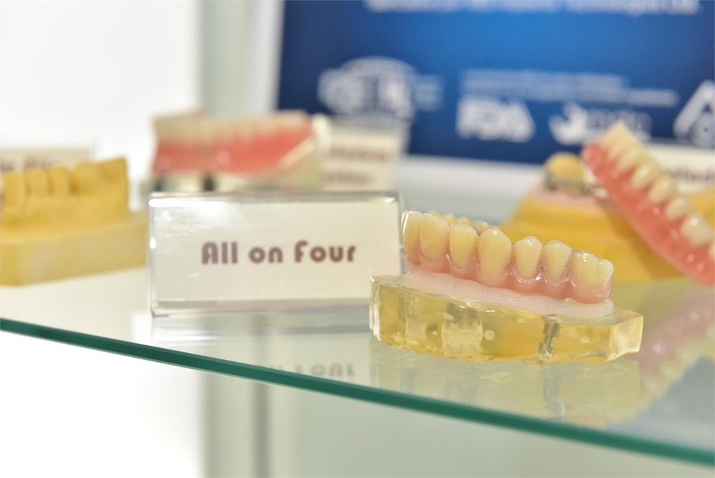 Implantes dentales All on Four ¿Los conoces?