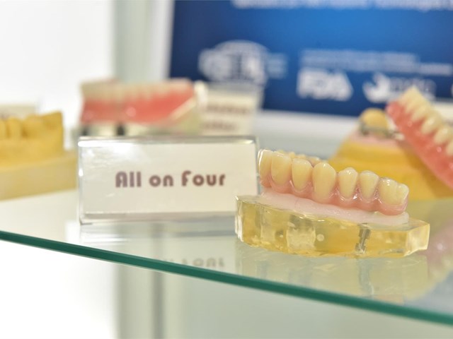 Implantes dentales All on Four ¿Los conoces?