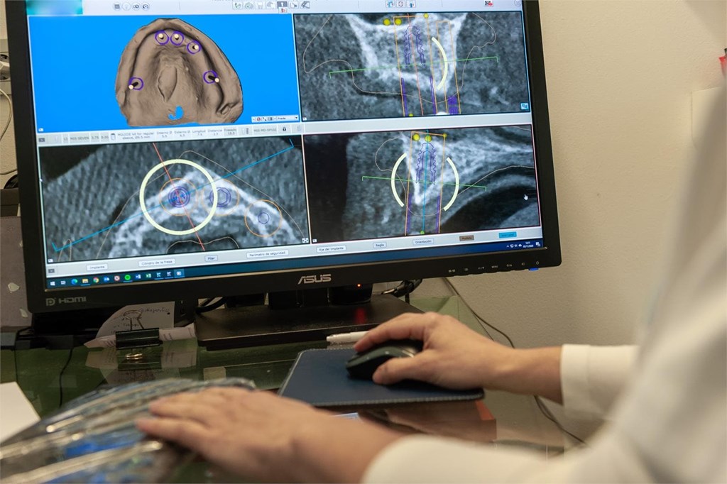 ¿Para qué se utilizan las gafas de realidad virtual 3D en nuestra clínica dental en Santiago?