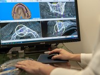 ¿Para qué se utilizan las gafas de realidad virtual 3D en nuestra clínica dental en Santiago?