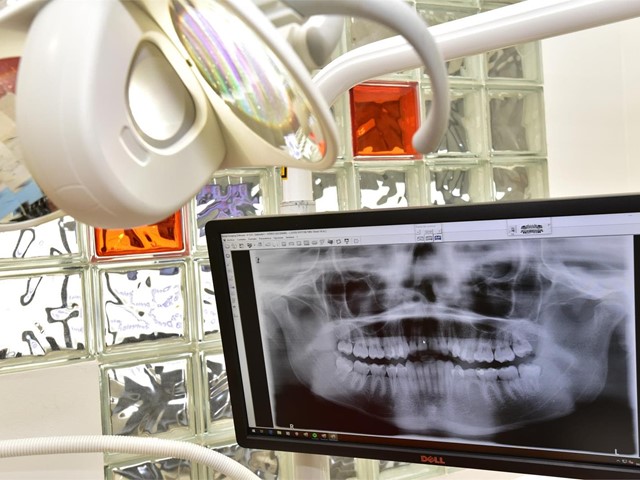 ¿Para qué sirve una endodoncia?