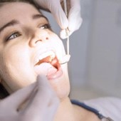 Periodontitis: causas, síntomas y tratamiento