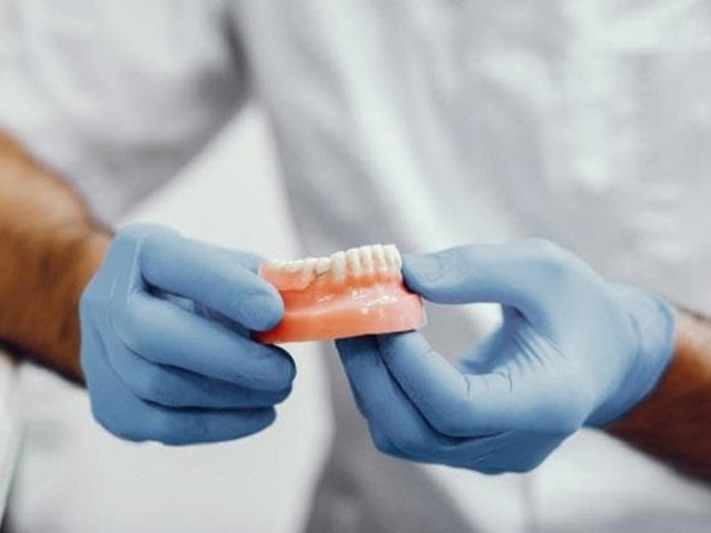 Prótesis dentales fijas o removibles, ¿cuál me conviene?