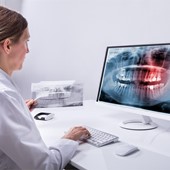 Prótesis con el Sistema CAD-CAM