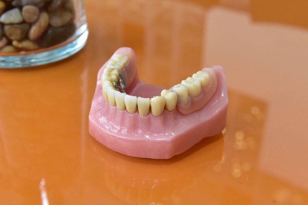 Foto 1 Recupera tu sonrisa con prótesis dentales en Milladoiro