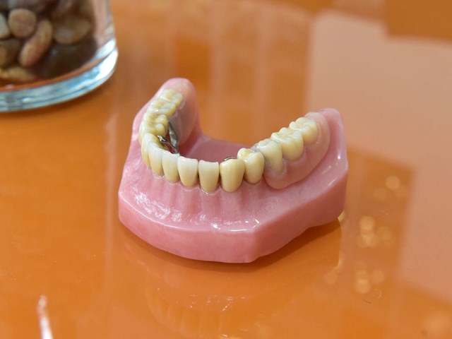 Recupera tu sonrisa con prótesis dentales en Milladoiro
