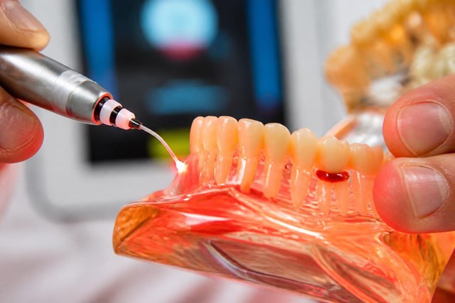 Salva tus encías y tus dientes con periodoncia y endodoncia en Milladoiro - Imagen 1