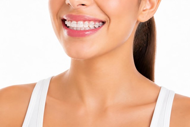 Sonríe con seguridad: ortodoncia con brackets metálicos o de zafiro en Milladoiro - Imagen 1