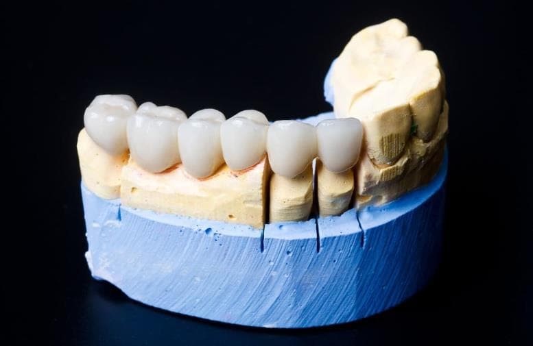 Sonríele al verano y luce tus prótesis dentales