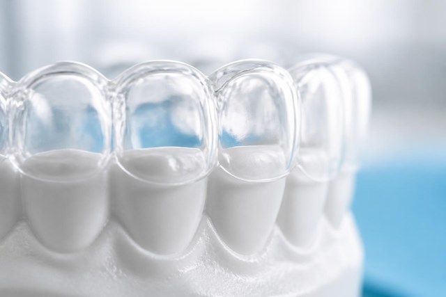 Sonrisa alineada sin brackets: ortodoncia invisible en Milladoiro - Imagen 1