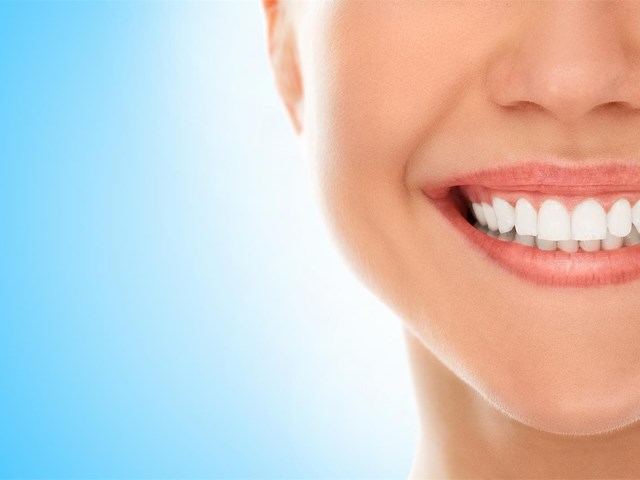 Tipos de carillas dentales: ¿en qué casos se suelen usar?