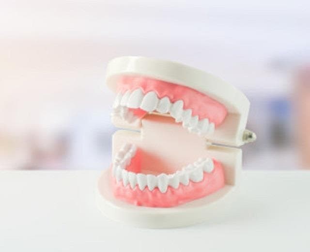 Todo lo que necesitas saber sobre las prótesis dental removible.