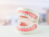 Todo lo que necesitas saber sobre las prótesis dental removible.