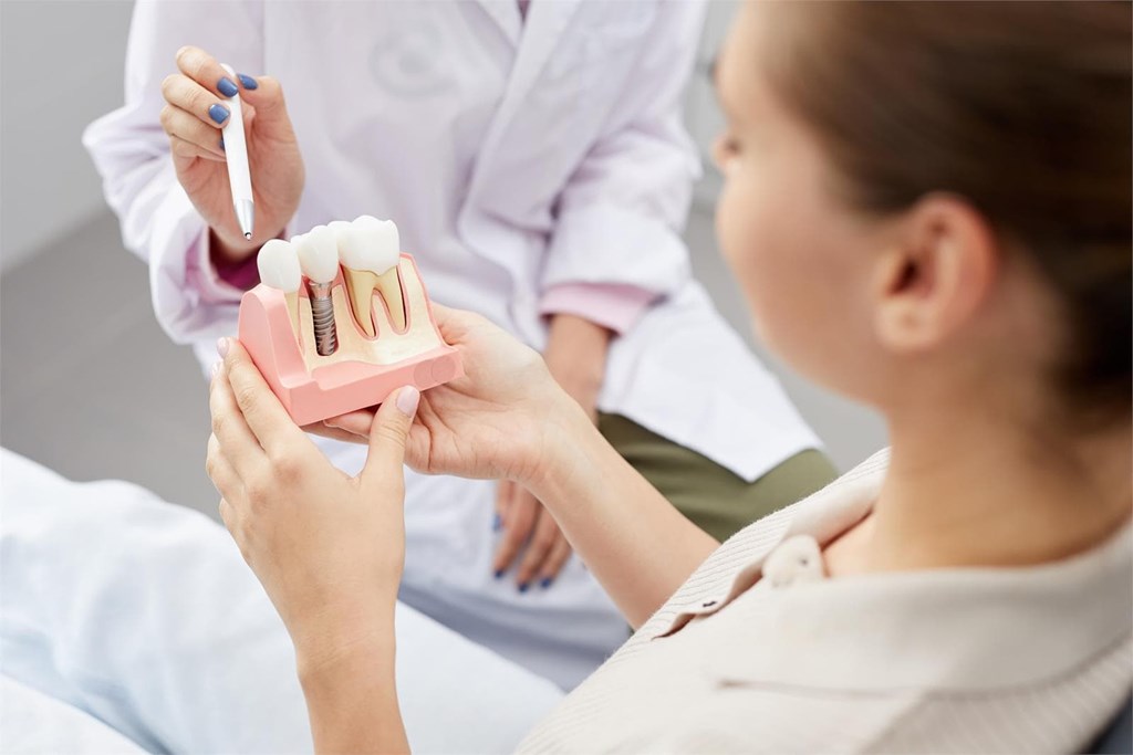 Todo lo que necesitas saber sobre los implantes dentales 