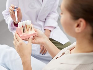 Todo lo que necesitas saber sobre los implantes dentales 
